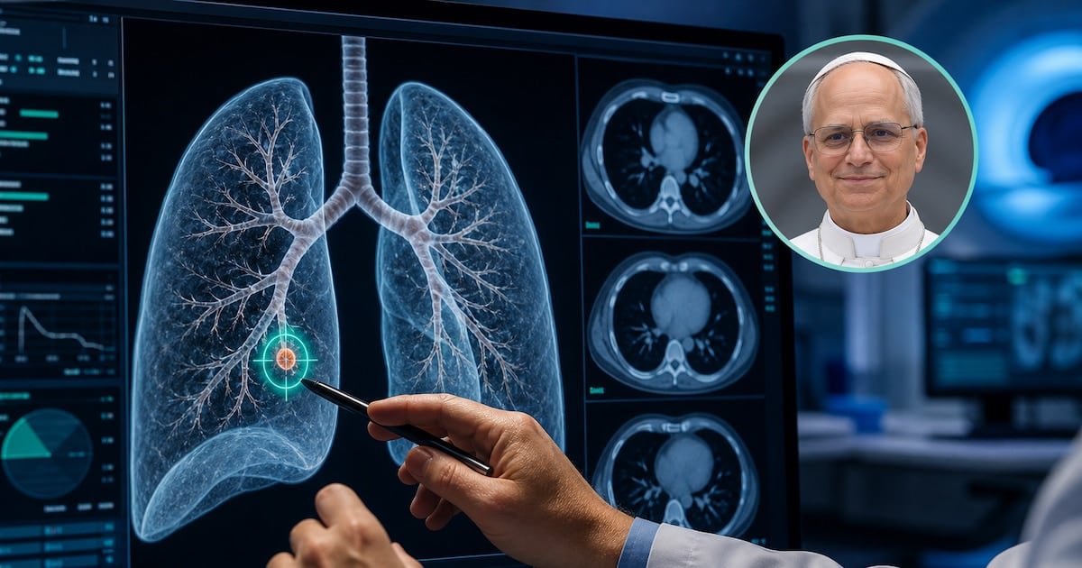 Pequeño en tamaño, grande en preguntas: el nódulo pulmonar que preocupa y se opera antes de noviembre
